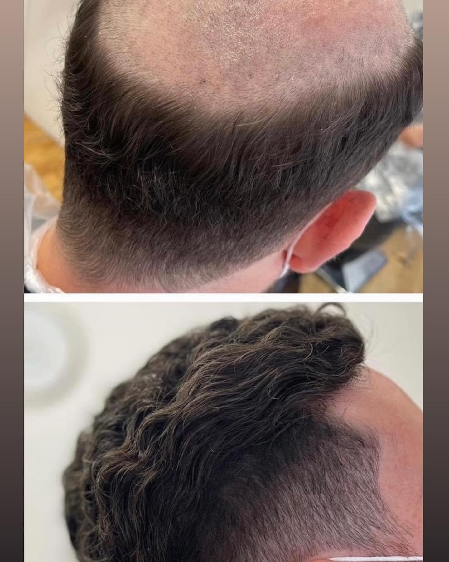 Youthful Transformation